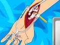 Cluiche Arm surgery 2