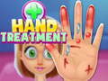 Cluiche Hand Treatment