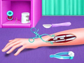 Cluiche Fracture Emergency Surgery