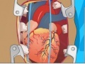 Cluiche Heart Surgery