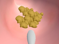 Cluiche Earwax Clinic